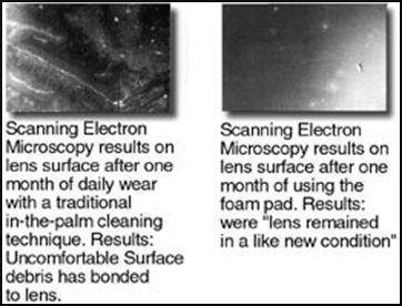 SEM micrographs